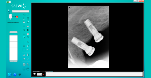 Sensor Intraoral Saevo Slim Tamanho 2 - SAEVO - Image 5